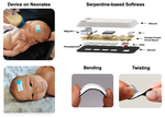 A wireless, skin-interfaced biosensor for cerebral hemodynamic monitoring in pediatric care